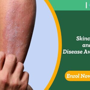 Skincare and Disease Awareness
