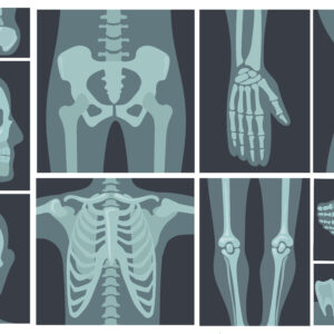 Radiography