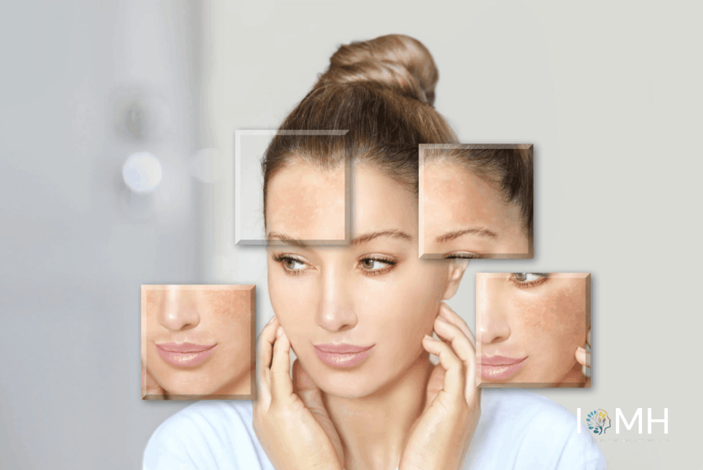 Young woman with close-up insets showing facial hyperpigmentation, dark spots, and uneven skin tone on forehead, cheeks, and around the mouth